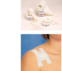 CEROTTO IN ROCCHETTO IN TELA EUROREEL MISURA 5X5 - Farmacianumberone.it